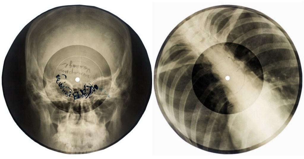 A CRIMINALLY HOOLIGAN TREND: THE STORY OF RUSSIAN BOOTLEG X-RAY&nbsp;ALBUMS